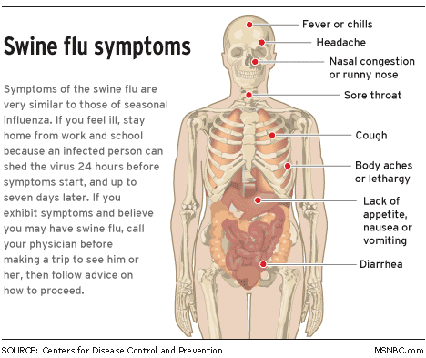 Influenza Suina Londra